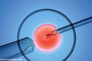 妇科专家